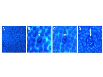 Protective Effects of Methanolic Leaf Extract of Citrullus colocynthis Combined with Kefir against 1,2-Dimethylhydrazine and High-Fat Diet-Induced Colorectal Cancer in Wistar Rats