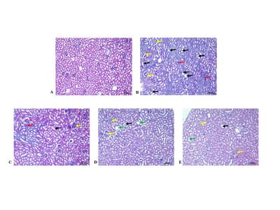 Tamarindus indica L. Seed Hydroalcoholic Extract as a Natural Inhibitor for Urolithiasis: Evidence from in vitro and in vivo Studies