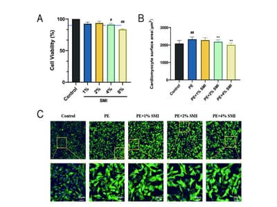 Shenmai Injection Attenuates Pressure Overload-Induced Cardiac Hypertrophy by Modulating HRAS