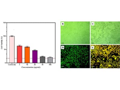 Green-Synthesized Tribulus terrestris-Mediated CuO Nanoparticle-Loaded CS/PVA Hydrogels: A Multifunctional Platform for Cancer Therapy and Antidiabetic Applications