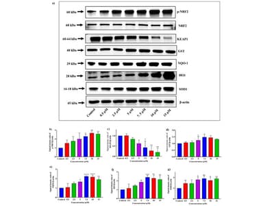 Modulation of KEAP1/NRF2-Regulated Anticancer Chemopreventive Signalling Pathways by Anacardic Acid in MCF7-ARE Human Breast Cancer Cells