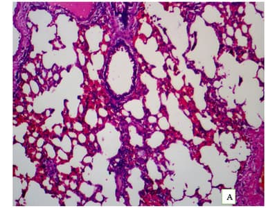 Daidzein Attenuates Allergic Asthma via NF-κB1 Downregulation and Cytokine Modulation: A Comprehensive Preclinical Evaluation