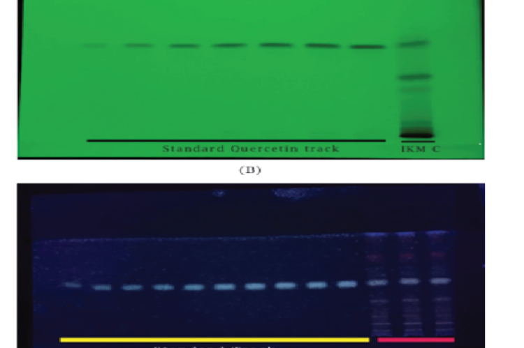  CAMAG® TLC Scanner 4 image of TLC plate showing the separation of  I. khasiana extracts. (A) Methanol-chloroform extract (IKM-C) with seven-level  concentration of quercetin. (B) Methanol-hexane extract (IKM-H) with ten-level  concentrations of β-sitosterol.