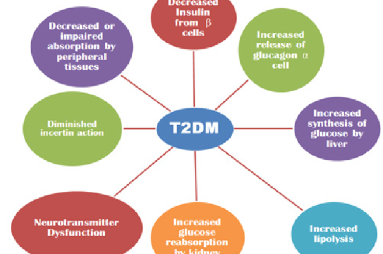 Causes of T2DM: Disease leading to T2DM.