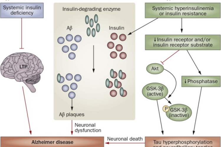 Altered insulin signaling in diabetes mellitus and contribution to Alzheimer’s disease pathophysiology.