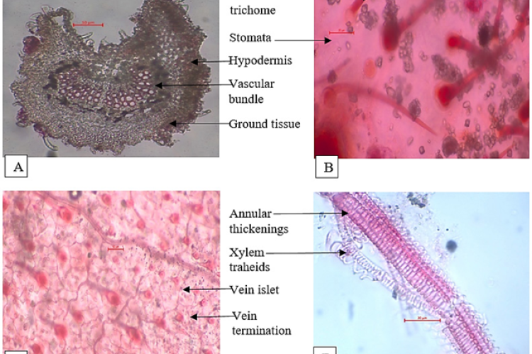 Cannabis sativa L., Leaf; A: Petiole, T.S. at 10X showing horse shoe shaped outline, hypodermis, vascular bundle, ground tissue, unicellular trichome