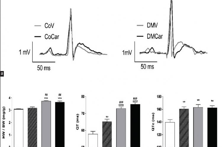 Carqueja (Baccharis trimera) Essential Oil Chronic Treatment Induces Ventricular Repolarization Disorder in Healthy Rats but Not in Type 2 Diabetic Rats