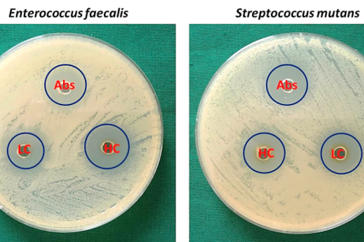 An indication of the antibacterial activity of a treatment against the tested bacterial strain (Enterococcus faecalis in the left and Streptococcus mutans in the right side) is the size of the clear zone (zone of inhibition) surrounding each sample. i.e, control group (Abs), Higher Concentration (HC) and Lower Concentration (LC).