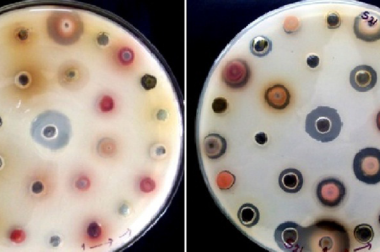 Antidandruff activity of Phyla nodiflora by zone of inhibition using agar cup plate method.