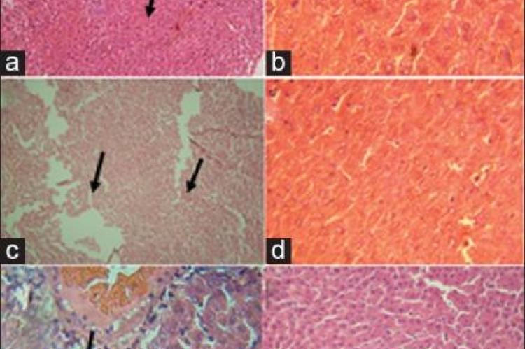 Photomicrograph of the liver sections at different magnifications,