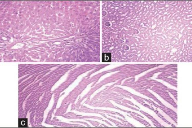 (a) The picture shows normal hepatocytes, central vein, and portal tracts (×40) (at column width); 
