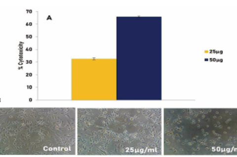  In vitro cytotoxic effect of R. indica leaf extract on MDA-MB breast cancer cells. A: Graph showing the % cytotoxicity of 25 µg and 50 µg of R.  indica extract. B: shows the morphology of the control and the cancer cells treated with R. indica extract (x20). The pictures are the representation of three  independent experiments.