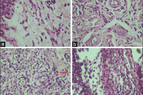 Histological illustration of lymphocytes on the inferior labial mucosa (a) Group A, (b) Group C, (c) Group B, and (d) Group D