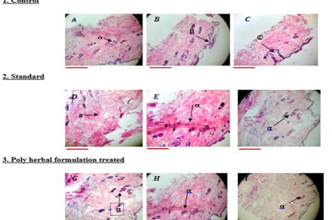 Histology photographs of excision wound model collected from different groups of rats on different days. (Magnification 10×) A) Control, B) Standard (framycetin), C) Poly herbal gel (PHG) treated (scale 100.0 pixel) α –sebaceous gland; β- epidermis; ©- granulated tissue; # -collagen.