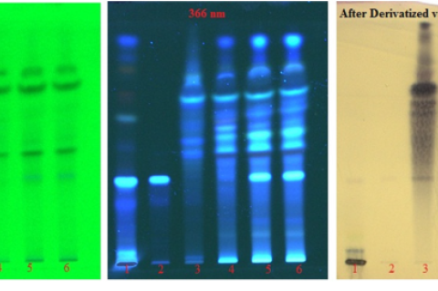 TLC Photodocumentation of Eclipta alba juice, sesame oil, KMT1, KMT2 and KMT3.Track 1-Eclipta alba juice; Track 2-Wedelolactone, Track 3-Raw oil, Track 4-KMT1, Track 5-KMT2, Track 6-KMT3.