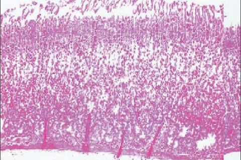 Histology of gastric mucosa of rats treated with aqueous ext. of Momordica cymbalaria fruits