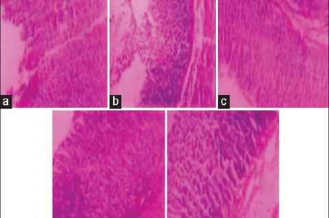 Jatropha gossypiifolia ameliorate aspirin plus pylorus ligated induced ulcer model: Photomicrograph of rat stomach mucosa section was showing (a) normal mucosal epithelium in control group; (b) ulcerated mucosa with discontinue of the lining of mucosal epithelium in aspirin treated animal; (c) normal mucosal epithelium with hyperplasia in methanol extract of Jatropha gossypiifolia 100 mg/kg treated animal; (d) normal mucosal epithelium with mild hyperplasia in methanol extract of Jatropha gossypiifolia 200 
