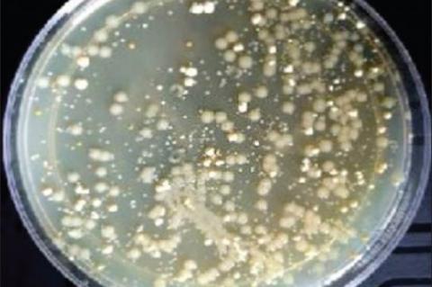 Isolation, Characterization, and Optimization of Protease‑Producing Bacterium Bacillus thuringiensis from Paddy Field Soil
