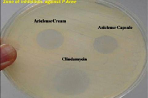 Zone of inhibition against Propionibacterium acne