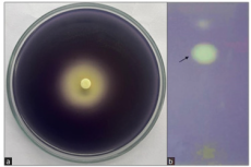 Corrigendum: Anti-quorum Sensing Potential of Adenanthera pavonina